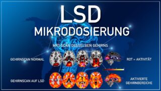Gehirn auf LSD: Mikrodosierung auch bei Promis? (Teil 7)