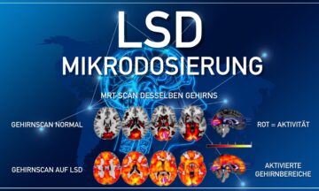 Gehirnscan-LSD-Mikrodosierung