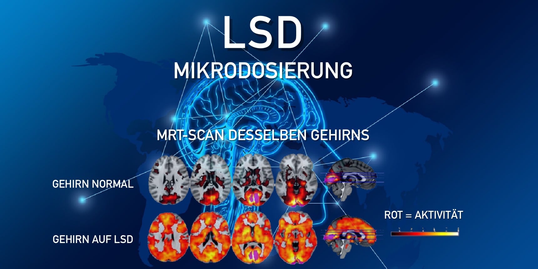 DMT Mikrodosierung