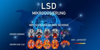 Gehirn auf LSD: Mikrodosierung killt auch Alzheimer (Teil 12)