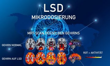 LSD MIkrodosierung