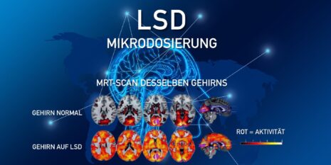 LSD MIkrodosierung